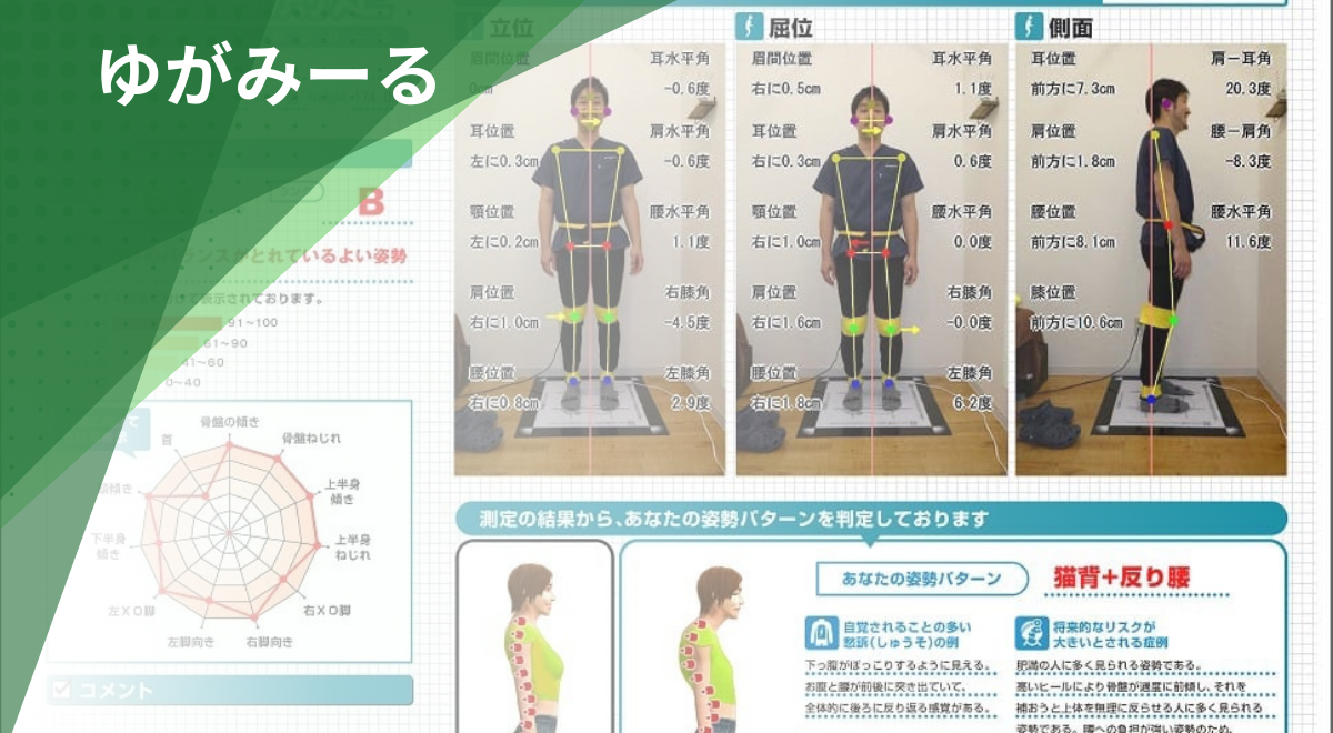 AI姿勢分析システム「ゆがみーる」による姿勢測定結果レポート
